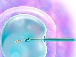 北京做三代试管婴儿技术，真的好么？